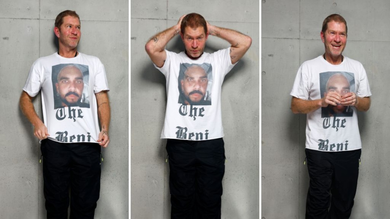 ‘Died for 10 minutes’: Dan Single opens up about near-fatal fall
