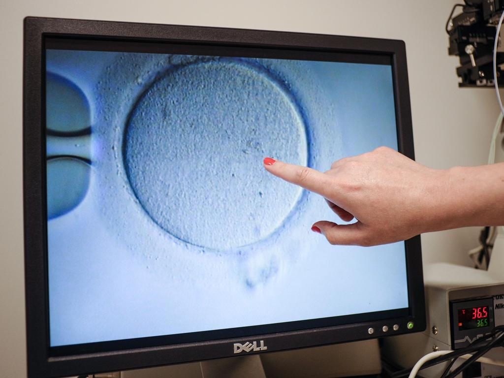 US fertility clinics are required to report some statistics, such as success rates, but there are no consequences if they do not comply. Advocates are calling for transparency. Picture: AFP