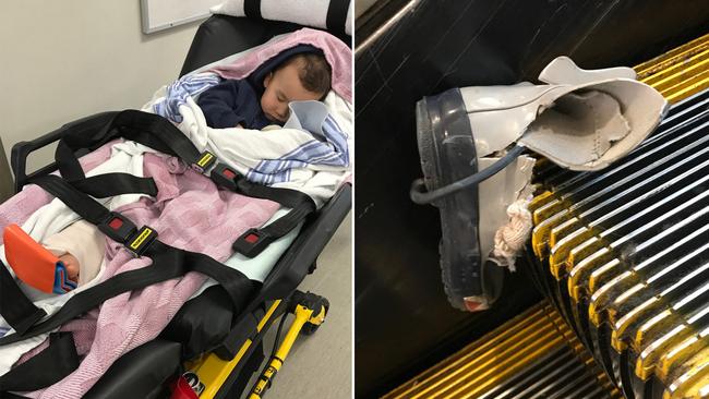Julian Diaczok’s leg was broken when his foot got caught in an escalator at the Vancouver International Airport. Picture: Andrea Diaczok