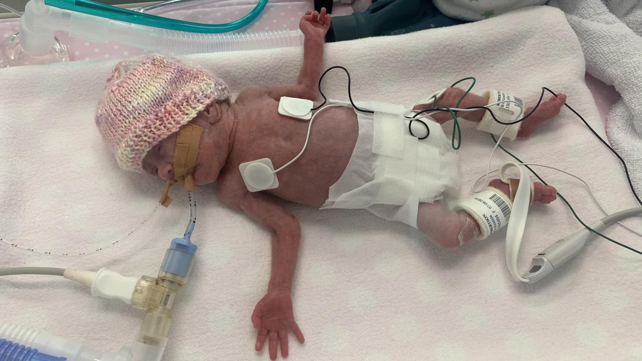 Royal Brisbane and Women’s Hospital: Premature baby survives being born ...