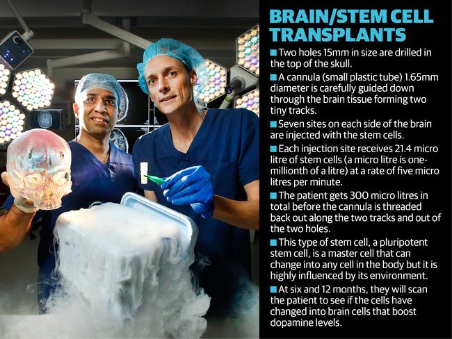 Neurosurgeon Girish Nair holds a 3D printed skull of the patient and neurologist Andrew Evans a vial of stem cells.