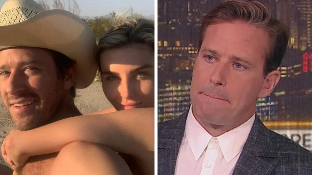 Armie Hammer admits to branding ex with a knife, insists ‘there wasn’t even blood’