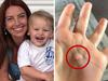 Tragedy of small bump on mum’s hand