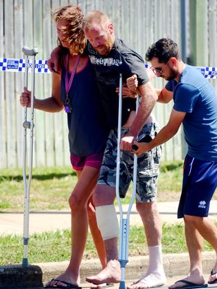 A backpacker on crutches after the stabbing in Home Hill.