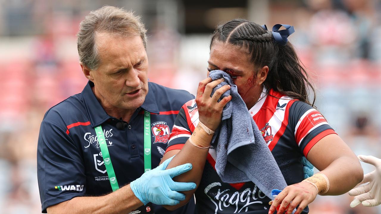 Taylor-Adeline Mapusua copped the worst of it. Photo by Ashley Feder/Getty Images