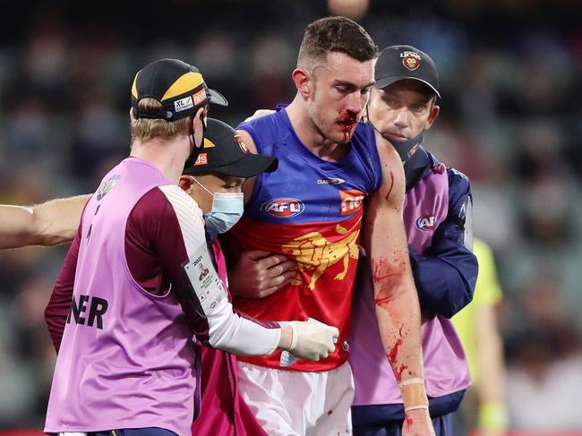 An injury to Daniel McStay will give coach Chris Fagan cause for concern. (Photo by Sarah Reed/AFL Photos via Getty Images)