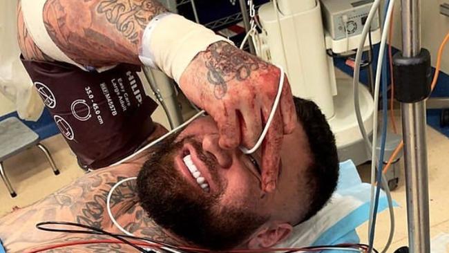 'Big Kash' posted on social media while being treated in hospital. Picture: Instagram