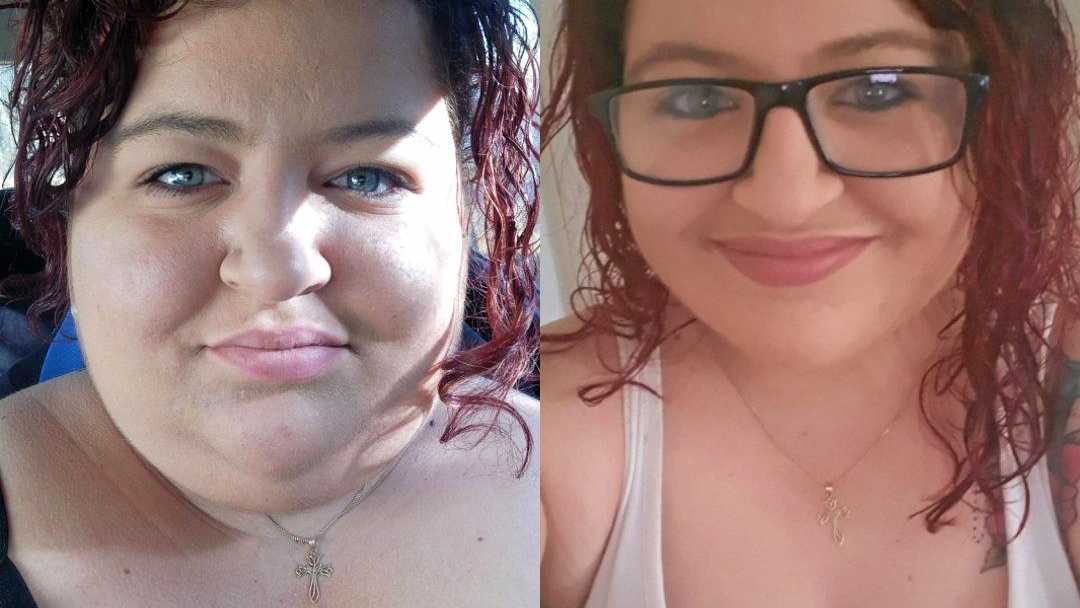 WEIGHT LOSS: Bundy teen's life saved by surgery