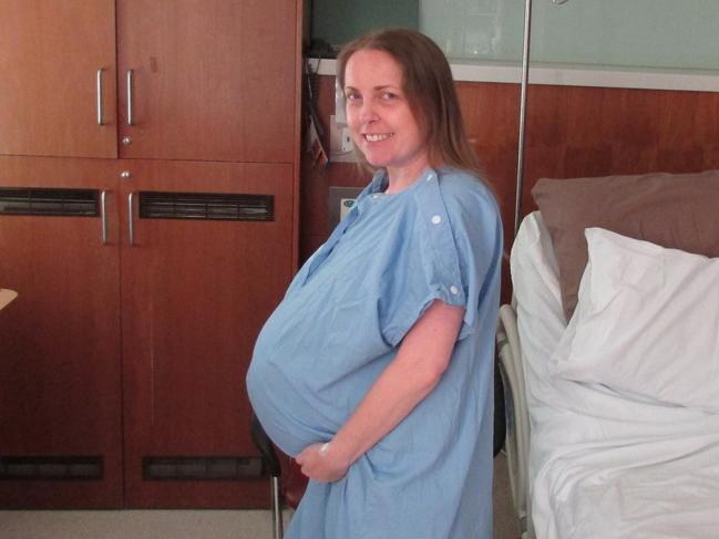 A heavily pregnant Laurie McDonnell, who had a heart-lung transplant in July 2002. In December, 2015, she gave birth to her son Sam.