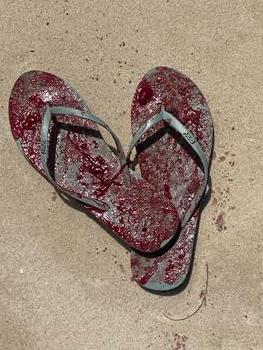 A pair of blood-soaked thongs.