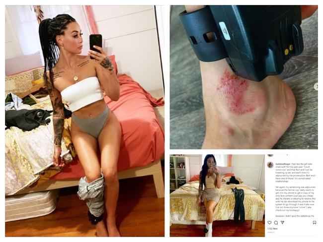 Animal rights activist Leah Whetton shows off her ankle bracelet to her Insta followers