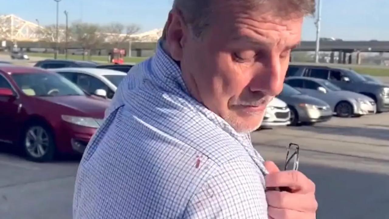 Tony Haste showing the blood from a victim on his shirt.