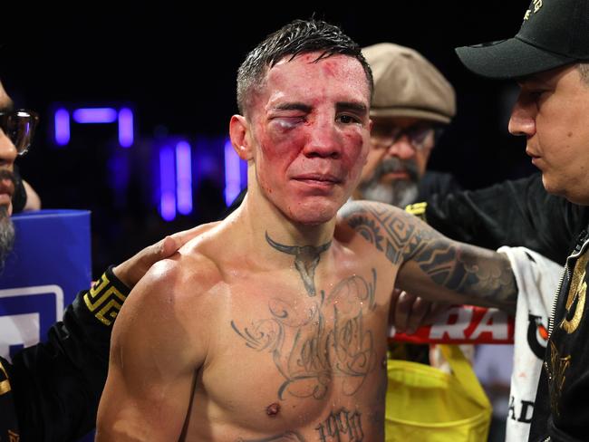 Oscar Valdez left the ring with a badly bruised eye after his fight with Emanuel Navarrete last weekend. Picture: Mikey Williams/Top Rank Inc/Getty Images