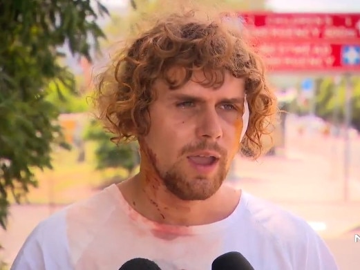 Aidan Power, 23, who was attacked at a home in Doonside on Monday morning. Picture: 7 News