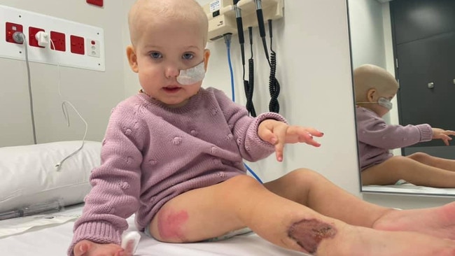 Young girl with cancer contracts flesh-eating fungus