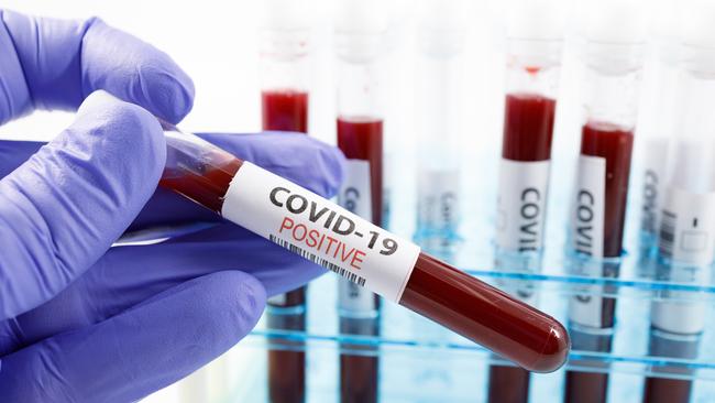 Most scientists say that people who have had COVID-19 gain some immunity — what they don’t know is whether that protection lasts a few months, a few years or a lifetime. Picture: iStock