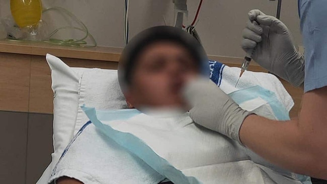 The boy spent the night in hospital after he was bashed by a group of boys in the Westfield Helensvale Shopping Centre food court this month.