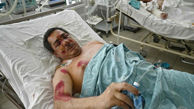 Genadiy, 51, injured in the Amstor mall missile attack, receives medical treatment at a hospital in Kremenchuk on Wednesday. Picture: AFP