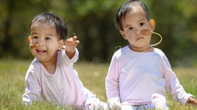 Bhutanese twins Nima (left) and Dawa (right) are recovering fast after leaving hospital two weeks ago. Picture: Alex Coppel