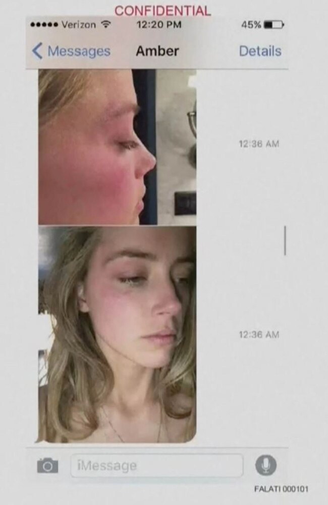 Photos of Amber Heard’s bruised face. Picture: Supplied