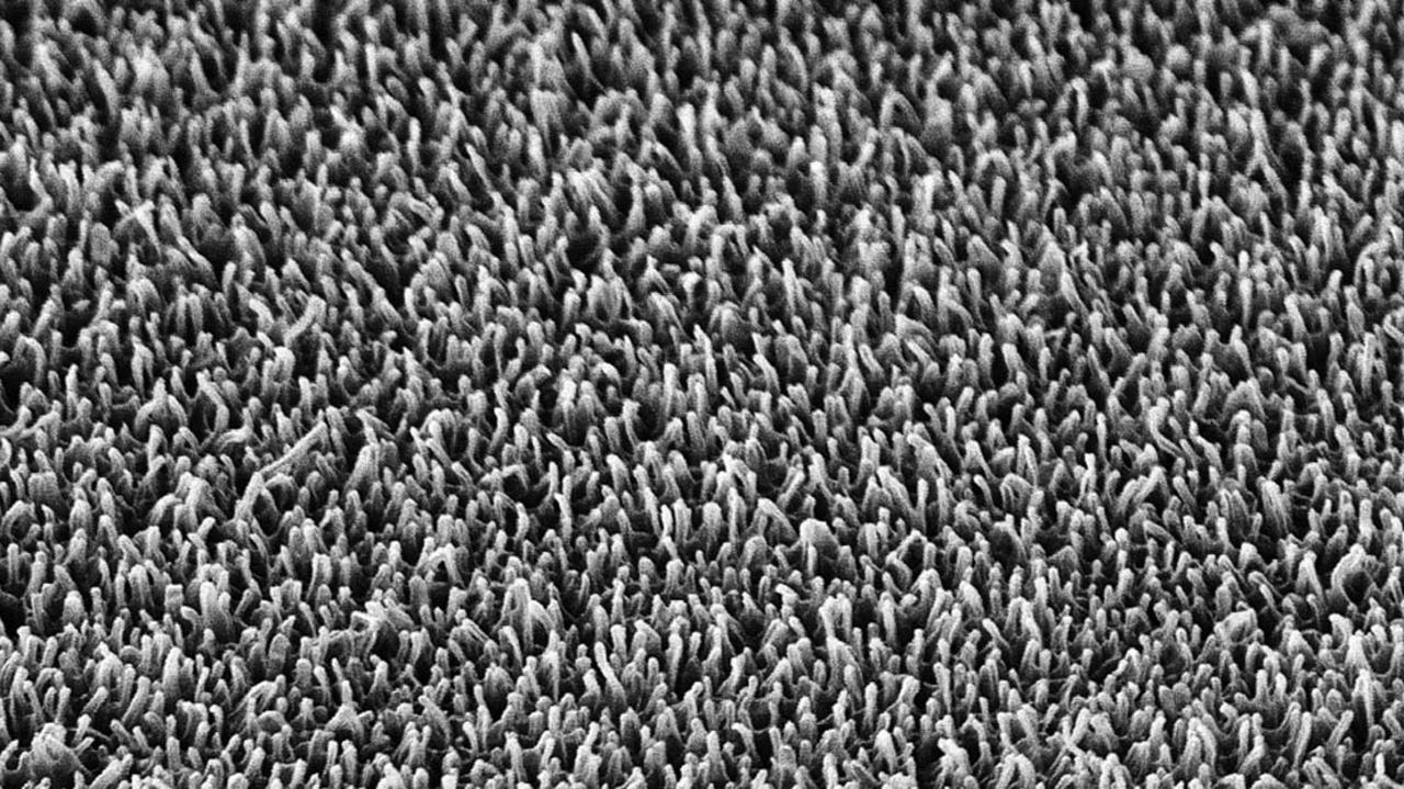 Nano-pillars on the surface of a dragonfly wing, magnified 20,000 times, act as blunt spikes that destroy bacteria on contact. Picture: RMIT