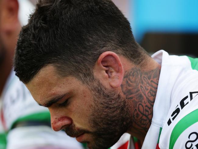 South Sydney's Adam Reynolds comes off the field with a suspected broken jaw during the Sydney Roosters v South Sydney rugby league game at Allianz Stadium, Sydney. Pic Brett Costello