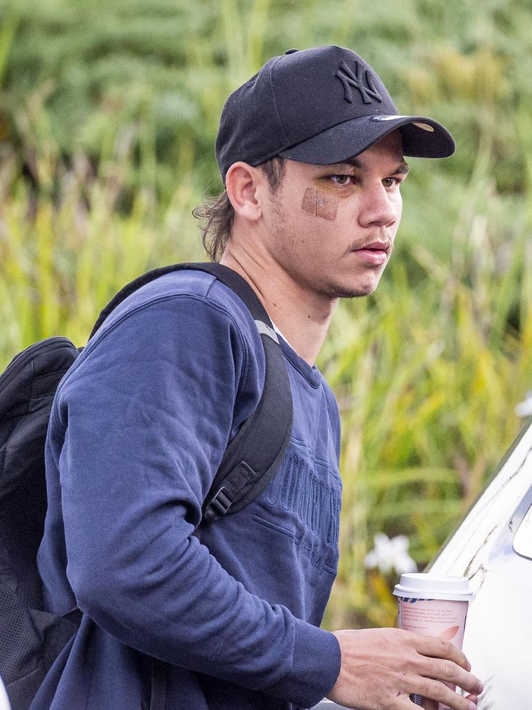 Rioli sporting a black eye. Picture: Jake Nowakowski