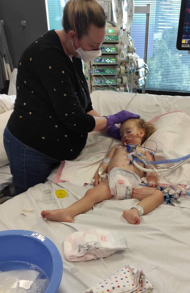 Ruby Grace Edwards being treated in hospital after Covid-19 triggered a neurological disease Acute Hemorrhagic Leukoencephalitis (AHLE), a very aggressive disease that causes an intense attack of inflammation in the brain &amp; spinal cord that damages the myelin. Picture: Supplied