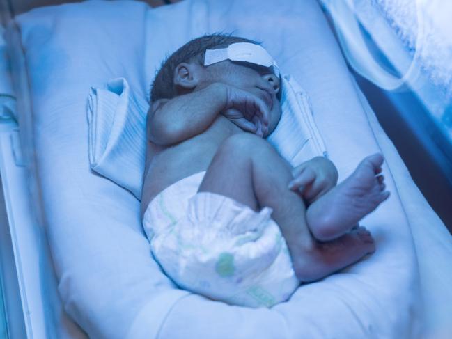 Cute little newborn baby getting treated for jaundice in incubator at the NICU