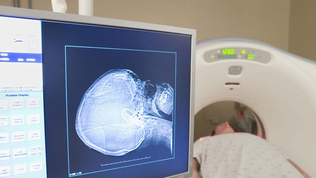 From November 1, breast cancer patients will be able to claim MRI scans on Medicare.