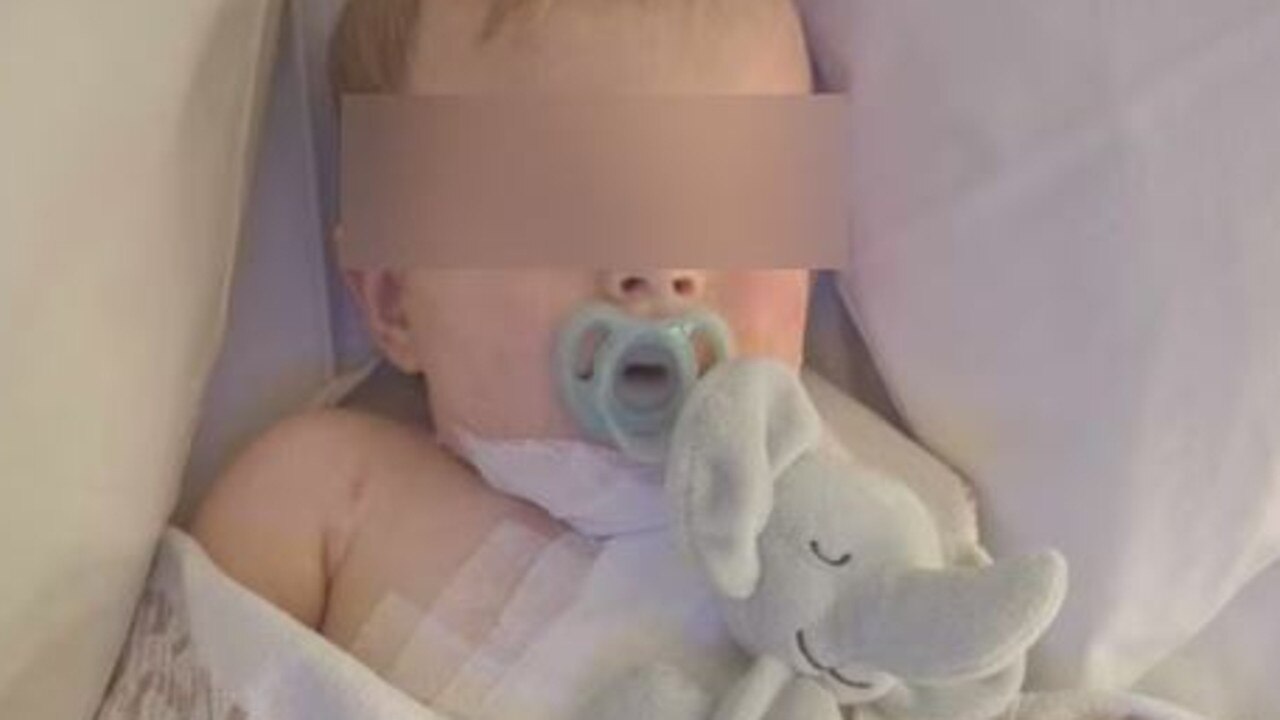 The baby was left with devastating injuries. Picture: Supplied