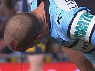 Robbo plays 70 with latest gruesome gash