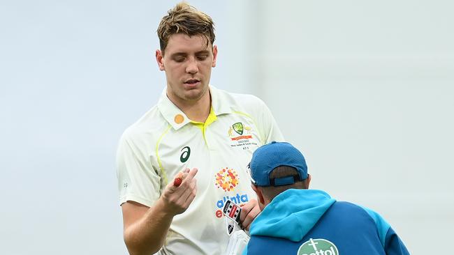 Cameron Green’s fractured finger. Picture: Quinn Rooney/Getty Images