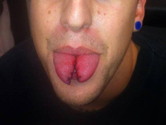 A Facebook image of a tongue split Brendan Russell said he had performed.