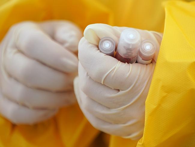 BERLIN, GERMANY - MARCH 27: A medical volunteer dressed in a protective suit and gloves holds vials of blood samples taken from visitors with symptoms to test them for Covid-19 infection at a tent set up outside a medical practice on March 27, 2020 in Berlin, Germany. Doctor Ulrike Lipke said she set up the tent as a way to offer testing yet avoid possible coronavirus infection inside the premises of her practice. Germany is seeking to radically ramp up its coronavirus testing capacity to up to 200,000 tests per day by the end of April as a means to allow people to return to work and hence get the crisis-stricken German economy back into gear. (Photo by Sean Gallup/Getty Images)