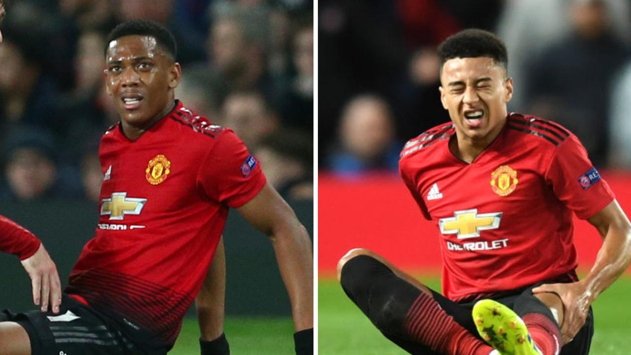 Manchester United could be without Jesse Lingard and Anthony Martial after both were injured in the Champions League.