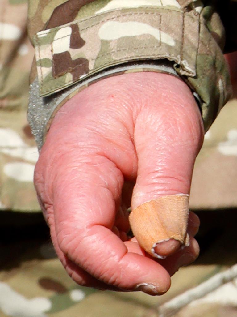 Charles’ hands have been looking worse for wear these days. Picture: Max Mumby/Indigo/Getty Images