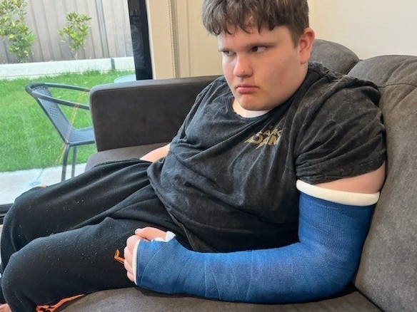 Photos of Chad, supplied by family. Chad with a broken hand, 2022