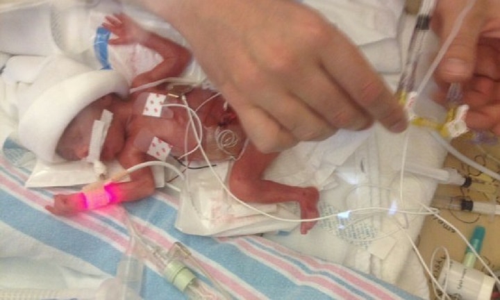 24 Week Premature Baby S Story Of Survival At 24 Weeks Kidspot