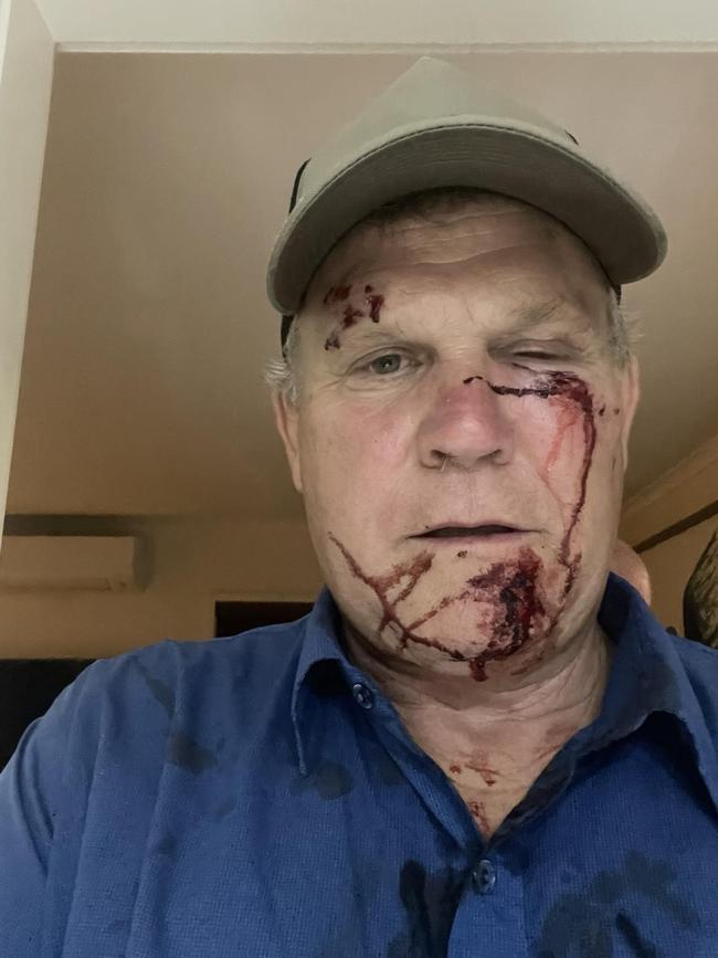 Former Barron River MP Michael Trout has been charged in relation to a brawl at Holloways Beach that occurred in May, 2024. Picture: Supplied