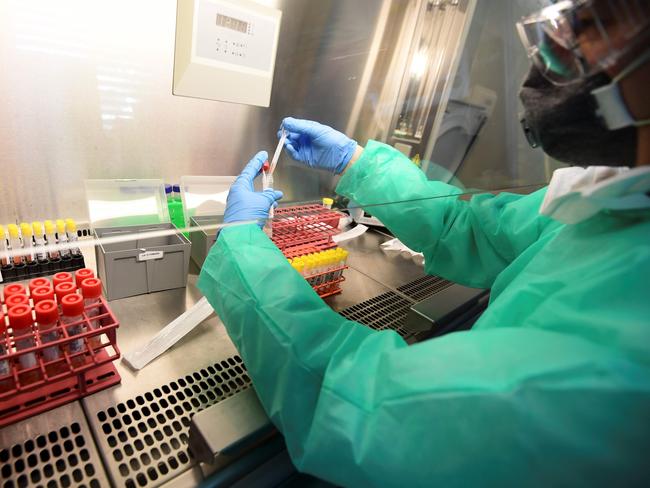 A medical staff member handles coronavirus samples at the microbiology laboratory of the Circolo di Varese hospital in Italy. Picture: AFP