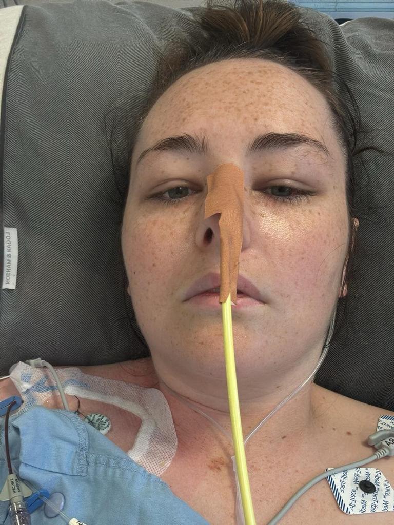 The 28-year-old then underwent a surgery to remove part of her bowel because doctors believed she was suffering with Crohn’s disease. Picture: Supplied by family.