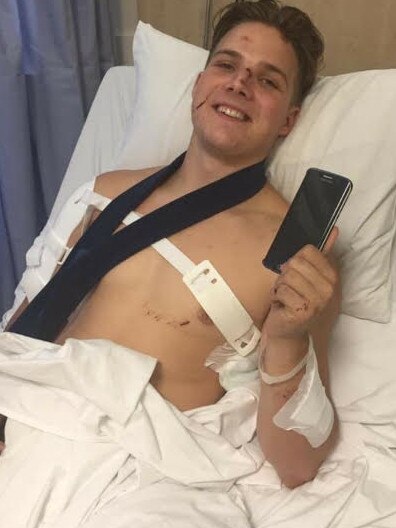 Harley Martlew, 17, in hospital after he was struck by his mum’s car.