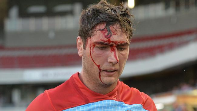 Rob Simmons had a tough day off one hour of sleep at Brookvale Oval against the Rebels. Pic: John Flitcroft