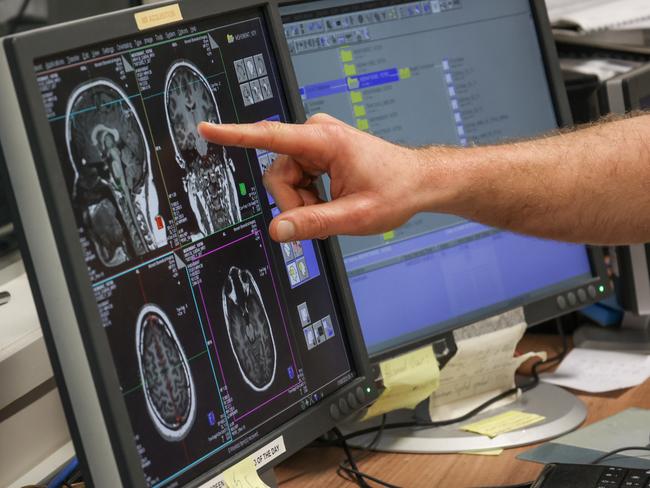 The test uses brain scans while the brain is in “idle mode” and not set on any specific task. Picture: Supplied