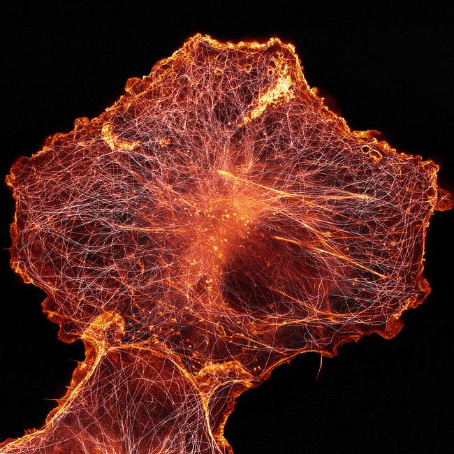 14th Place African green monkey cell (COS-7) stained for actin and microtubules Picture: Andrew Moore & Dr. Erika Holzbaur