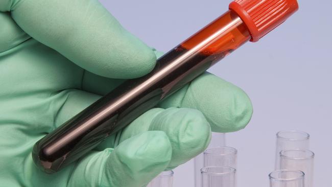 Blood test errors rise at Cairns Hospital under digital program | The ...