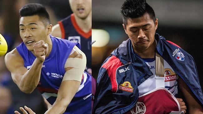 Lin Jong taped up a different shoulder to his injured one in the VFL Grand Final.