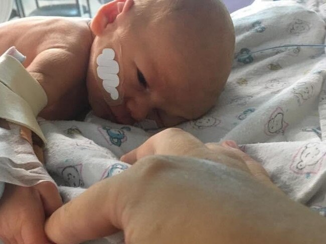 Beaconsfield baby Lucas Baker did not just surprise his parents by arriving six weeks early – the biggest shock came 10 days later when he was diagnosed with viral meningitis. Picture: Contributed