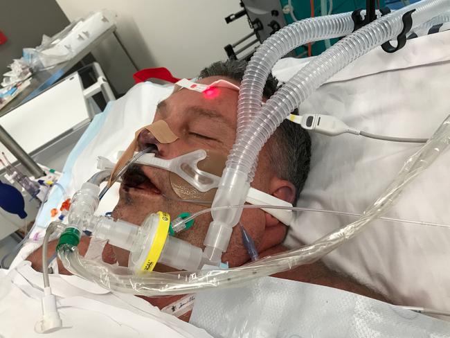 Doctros have said they've never seen anyone so ill as Jason 'Buddy' Miller survive. The 48-year-old single father, of Queenscliff, battled severe sepsis. He will lose both his hands and his feet. Pictured in ICU at Northern Beaches Hospital. Picture: Supplied.